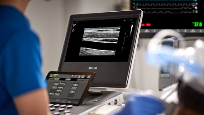 Philips&rsquo; intelligent end-to-end ultrasound innovations take center stage at the Ultrasound World Congress &ndash; enabling more confident decision making, for more people in more places